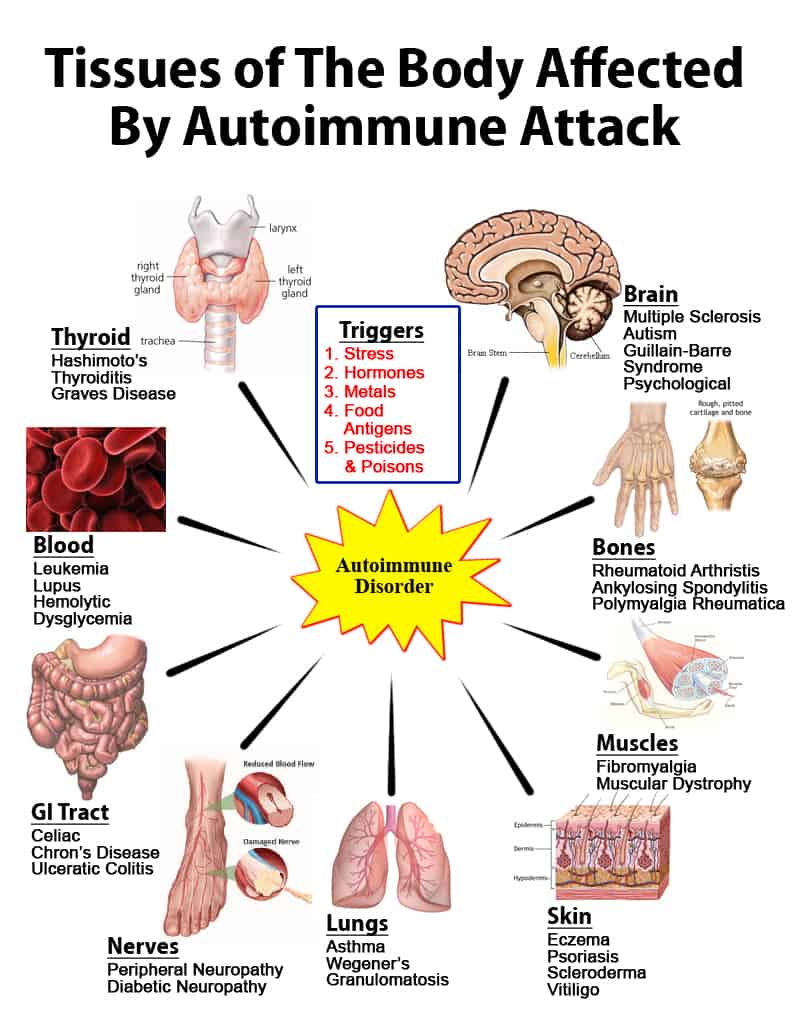 Auto Immune System NAET Dubai