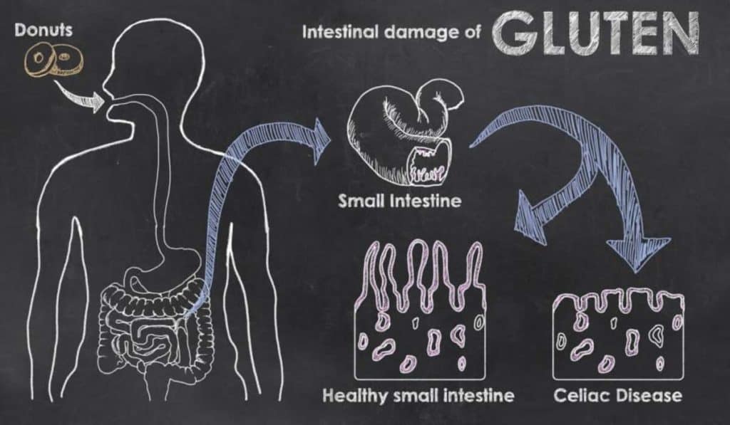Intestinal damage of gluten 