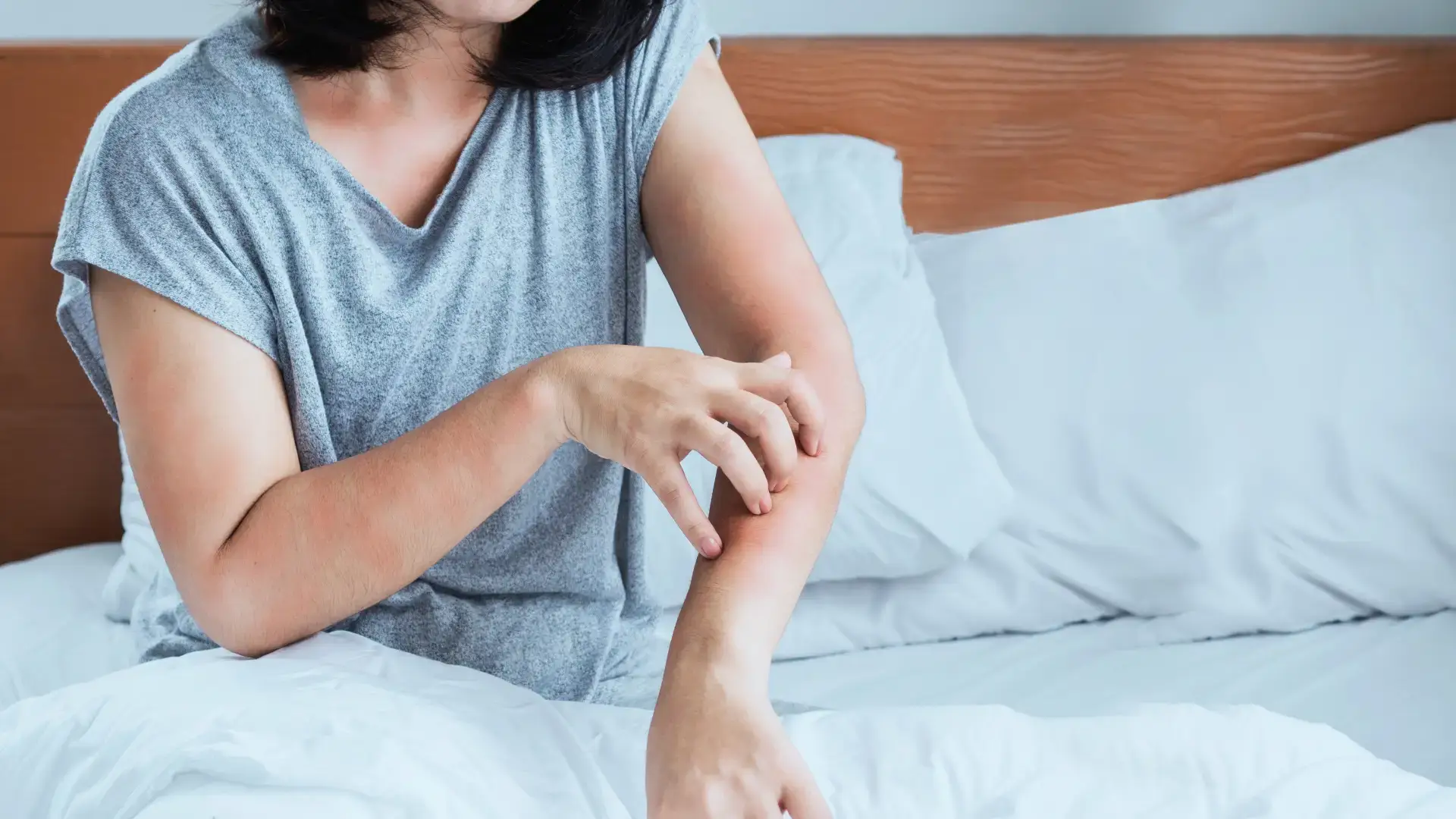 The photo shows a woman with eczema, which is causing the redness on her arms and the itching she is scratching.