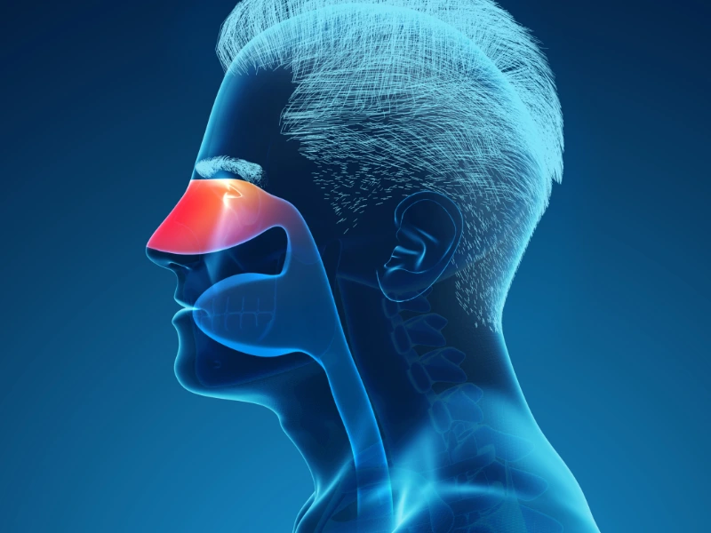 Understanding Allergic SInusitis