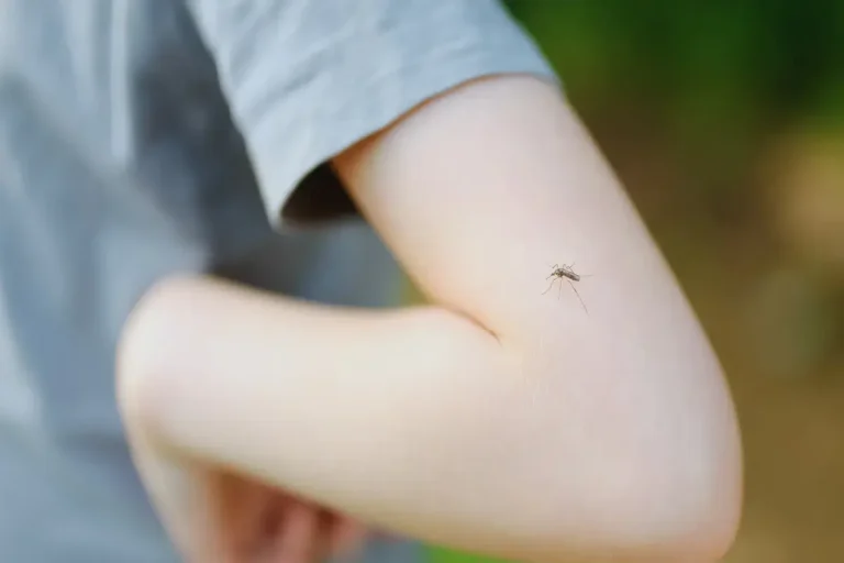 Insect Bite Allergic Reactions in Dubai